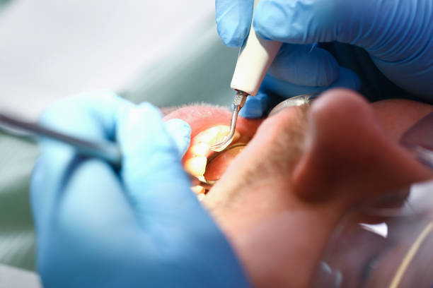 Best Emergency Dental Care for Trauma or Injury in Frisco City, AL