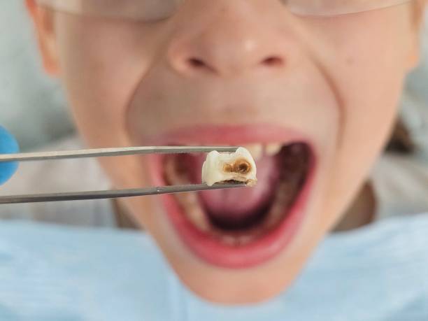, AL Emergency Dentist Company